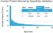 Analysis of HuProt(TM) microarray containing more than 19,000 full-length human proteins using SERBP1 antibody. These results demonstrate the foremost specificity of the SERBP1/3494 mAb. Z- and S- score: The Z-score represents the strength of a signal that an antibody (in combination with a fluorescently-tagged anti-IgG secondary Ab) produces when binding to a particular protein on the HuProt(TM) array. Z-scores are described in units of standard deviations (SD's) above the mean value of all signals generated on that array. If the targets on the HuProt(TM) are arranged in descending order of the Z-score, the S-score is the difference (also in units of SD's) between the Z-scores. The S-score therefore represents the relative target specificity of an Ab to its intended target.
