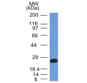 Western blot testing of human Ramos cell lysate with CD79a antibody (clone IGA/1406). Expected molecular weight: 25-47 kDa depending on glycosylation level.~
