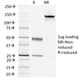 SDS-PAGE analysis of purified, BSA-free CD79a antibody (clone IGA/1406) as conf