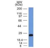 Western blot testing of human Ramos cell lysate with CD79a antibody (clone IGA/1406). Expected molecular weight: 25-47 kDa depending on glycosylation level.