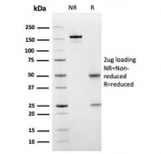 SDS-PAGE analysis of purified, BSA-free SERBP1 antibody as confirmation of integrity and purity.