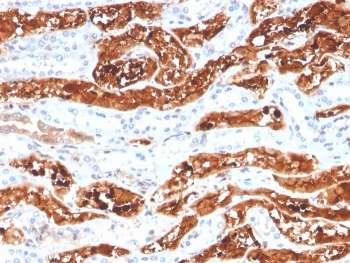 IHC staining of FFPE human kidney with FGF21 antibody. HIER: boil tissue sections in pH 9 10mM Tris with 1mM EDTA for 20 min and allow to cool before testing.