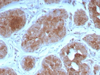IHC staining of FFPE human breast with FGF21 antibody. HIER: boil tissue sections in pH 9 10mM Tris with 1mM EDTA for 20 min and allow to cool before testing.