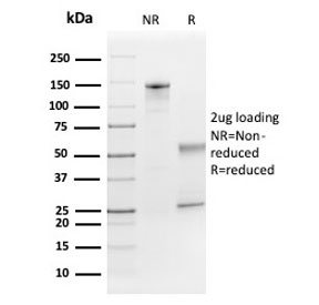 SDS-PAGE analysis of purified, BSA-free FGF21 antibody as confirmation of integrity and purity.