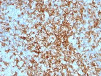 IHC staining of FFPE human tonsil with CD43 antibody. HIER: boil tissue sections in pH 9 10mM Tri