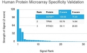 Analysis of HuProt(TM) microarray containing more than 19,000 full-length human proteins using SERBP1 / PAI-RBP1 antibody. These results demonstrate the foremost specificity of the SERBP1/3492 mAb. Z- and S- score: The Z-score represents the strength of a signal that an antibody (in combination with a fluorescently-tagged anti-IgG secondary Ab) produces when binding to a particular protein on the HuProt(TM) array. Z-scores are described in units of standard deviations (SD's) above the mean value of all signals generated on that array. If the targets on the HuProt(TM) are arranged in descending order of the Z-score, the S-score is the difference (also in units of SD's) between the Z-scores. The S-score therefore represents the relative target specificity of an Ab to its intended target.