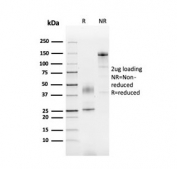 SDS-PAGE analysis of purified, BSA-free PAI-RBP1 antibody as confirmation of integrity and purity.