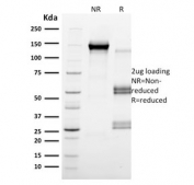 SDS-PAGE analysis of purified, BSA-free CD79b antibody (clone IGB/2555) as confirmation of integrity and purity.