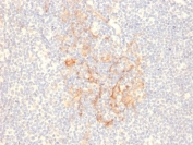 IHC staining of FFPE human tonsil with CD79b antibody (clone IGB/2555). HIER: boil tissue sections in pH 9 10mM Tris with 1mM EDTA for 20 min and allow to cool before testing.