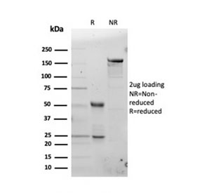 SDS-PAGE analysis of purified, BSA-free FTL antibody as confirmation of integrity and purity.