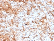 IHC staining of FFPE human pancreas with FTL antibody. HIER: boil tissue sections in pH 9 10mM Tris with 1mM EDTA for 20 min and allow to cool before testing.