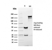SDS-PAGE analysis of purified, BSA-free recombinant PSA antibody (clone KLK3/4551R) as confirmation of integrity and purity.