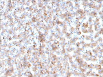 IHC staining of FFPE human liver with APOB antibody. HIER: boil tissue sections in pH 9 10mM Tris with 1mM EDTA for 20 min and allow to cool before testing.