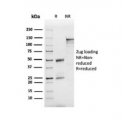 SDS-PAGE analysis of purified, BSA-free APOB antibody as confirmation of integrity and purity.