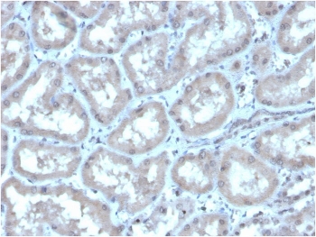 IHC staining of FFPE human kidney with CA9 antibody. HIER: boil tissue sections in pH 9 10mM Tris with 1mM EDTA for 20 min and allow to cool before testing.