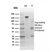 SDS-PAGE analysis of purified, BSA-free CA9 antibody as confirmation of integrity and purity.