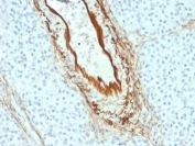 IHC staining of FFPE human pancreas with Elastin antibody (clone ELN/2069). HIER: boil tissue sections in pH 9 10mM Tris with 1mM EDTA for 20 min and allow to cool before testing.