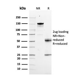 SDS-PAGE analysis of purified, BSA-free RAD51 antibody as confirmation of integrity and purity.