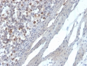 IHC staining of FFPE human kidney with RAD51 antibody. HIER: boil tissue sections in pH 9 10mM Tris with 1mM EDTA for 20 min and allow to cool before testing.
