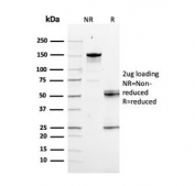 SDS-PAGE analysis of purified, BSA-free RAD51 antibody as confirmation of integrity and purity.