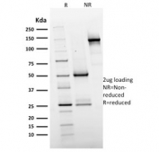 SDS-PAGE analysis of purified, BSA-free EGFR antibody (clone GFR/2596) as confirmation of integrity and purity.