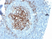 IHC staining of FFPE human tonsil with recombinant CD23 antibody (clone FCER2/4395R). HIER: boil tissue sections in pH 9 10mM Tris with 1mM EDTA for 20 min and allow to cool before testing.