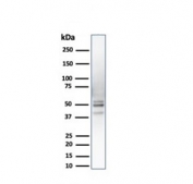 Western blot testing of human liver lysate with PSMD4 antibody. Predicted molecular weight ~41 kDa, routinely observed at ~50 kDa.