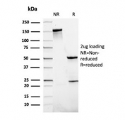 SDS-PAGE analysis of purified, BSA-free SLAMF7 antibody as confirmation of integrity and purity.