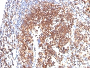 IHC staining of FFPE human tonsil with SLAMF7 antibody. HIER: boil tissue sections in pH 9 10mM Tris with 1mM EDTA for 20 min and allow to cool before testing.
