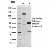 SDS-PAGE analysis of purified, BSA-free recombinant HHV8 antibody as confirmation of integrity and purity.