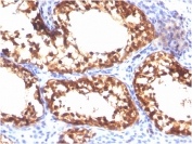 IHC staining of FFPE human testis with Vinculin antibody (clone VCL/3617). HIER: boil tissue sections in pH 9 10mM Tris with 1mM EDTA for 20 min and allow to cool before testing.
