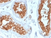 IHC staining of FFPE human testis with Vinculin antibody (clone VCL/3617). HIER: boil tissue sections in pH 9 10mM Tris with 1mM EDTA for 20 min and allow to cool before testing.