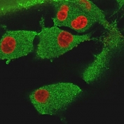Immunofluorescent staining of PFA-fixed human U-87 MG cells with Vinculin antibody (clone VCL/3617, green) and Reddot nuclear stain (red).