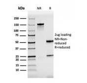 SDS-PAGE analysis of purified, BSA-free recombinant ZAP70 antibody as confirmation of integrity and purity.