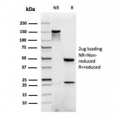 SDS-PAGE analysis of purified, BSA-free recombinant Catenin beta antibody (clone rCTNNB1/1507) as confirmation of integrity and purity.