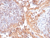 IHC staining of FFPE human tonsil with recombinant Catenin beta antibody (clone rCTNNB1/1507). HIER: boil tissue sections in pH 9 10mM Tris with 1mM EDTA for 20 min and allow to cool before testing.