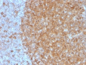 IHC staining of FFPE human tonsil with CD71 antibody (clone TFRC/3630). HIER: boil tissue sections in pH 9 10mM Tris with 1mM EDTA for 20 min and allow to cool before testing.