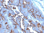 IHC staining of FFPE human tonsil with CD71 antibody (clone TFRC/3630). HIER: boil tissue sections in pH 9 10mM Tris with 1mM EDTA for 20 min and allow to cool before testing.