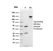 SDS-PAGE analysis of purified, BSA-free CD71 antibody (clone TFRC/3630) as confirmation of integrity and purity.