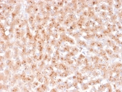 IHC staining of FFPE human liver with Transthyretin antibody (clone TTR/4292). HIER: boil tissue sections in pH 9 10mM Tris with 1mM EDTA for 20 min and allow to cool before testing.