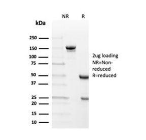 SDS-PAGE analysis of purified, BSA-free Transthyretin antibody (clone TTR/4292) as confirmation of integrity and purity.