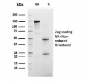 SDS-PAGE analysis of purified, BSA-free BAP1 antibody as confirmation of integrity and purity.
