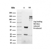 SDS-PAGE analysis of purified, BSA-free recombinant Interferon gamma antibody as confirmation of integrity and purity.