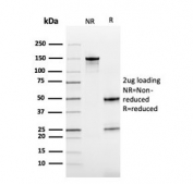 SDS-PAGE analysis of purified, BSA-free Cystatin B antibody as confirmation of integrity and purity.