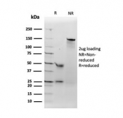 SDS-PAGE analysis of purified, BSA-free ACE antibody (clone ACE/3762) as confirmation of integrity and purity.