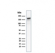 Western blot testing of human kidney lysate with ACE antibody. Expected molecular weight 140-170+ kDa depending on glycosylation level.