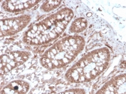 IHC staining of FFPE human colon with ACE antibody. HIER: boil tissue sections in pH 9 10mM Tris with 1mM EDTA for 20 min and allow to cool before testing.