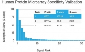 Analysis of HuProt(TM) microarray containing more than 19,000 full-length human proteins using Cytokeratin 5/6 antibody (clone KRT5.6/2090). These results demonstrate the foremost specificity of the KRT5.6/2090 mAb. Z- and S- score: The Z-score represents the strength of a signal that an antibody (in combination with a fluorescently-tagged anti-IgG secondary Ab) produces when binding to a particular protein on the HuProt(TM) array. Z-scores are described in units of standard deviations (SD's) above the mean value of all signals generated on that array. If the targets on the HuProt(TM) are arranged in descending order of the Z-score, the S-score is the difference (also in units of SD's) between the Z-scores. The S-score therefore represents the relative target specificity of an Ab to its intended target.