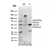 SDS-PAGE analysis of purified, BSA-free Integrin alpha V + beta 6 antibody (clone AvB6 53a.2) as confirmation of integrity and purity.