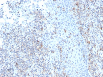 IHC staining of FFPE human tonsil with recombinant CD50 antibody (clone rICAM3/1019). HIER: boil tissue sections in pH 9 10mM Tris with 1mM EDTA for 20 min and allow to cool before testing.~